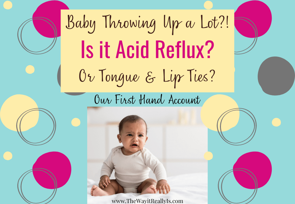 reflux or tongue tie