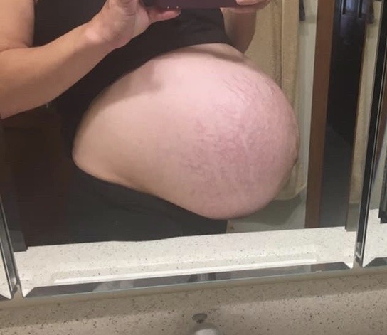 34 weeks pregnant with twins HUGE tummy