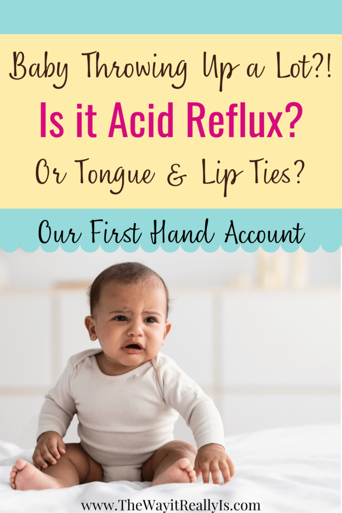 Projectile Vomiting Baby