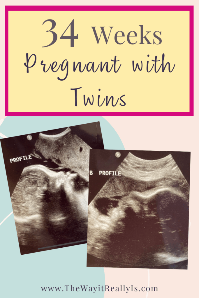 34 weeks pregnant with twins text and images of ultrasounds of my twins