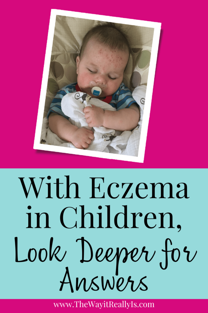 With eczema in children, look deeper for answers text with a photo of my oldest when he had eczema so bad that he'd scratch his face and ankles til he bled. 