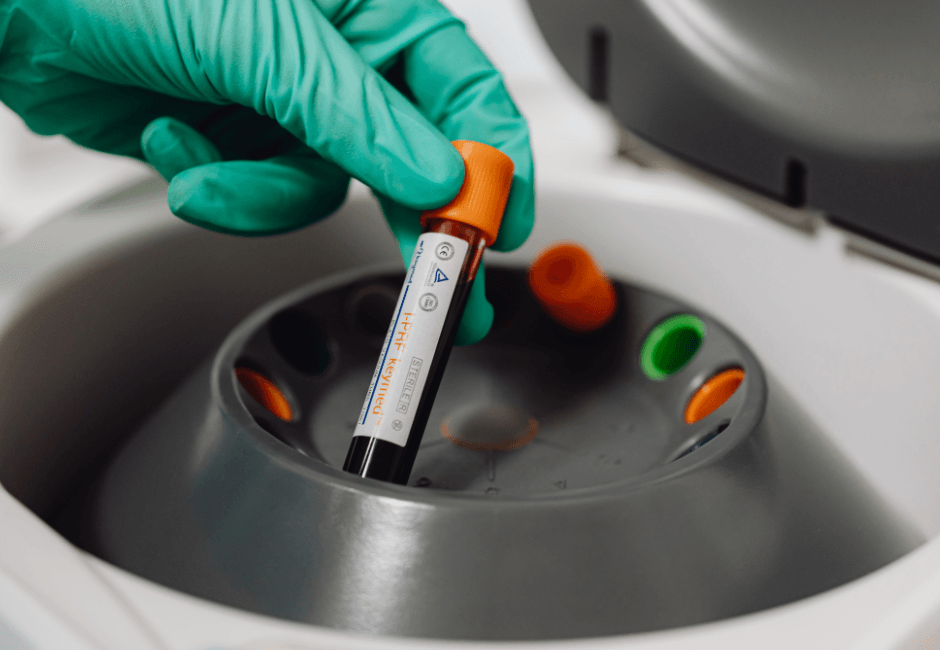 Laboratory technician handling blood sample for Superpower biomarker test